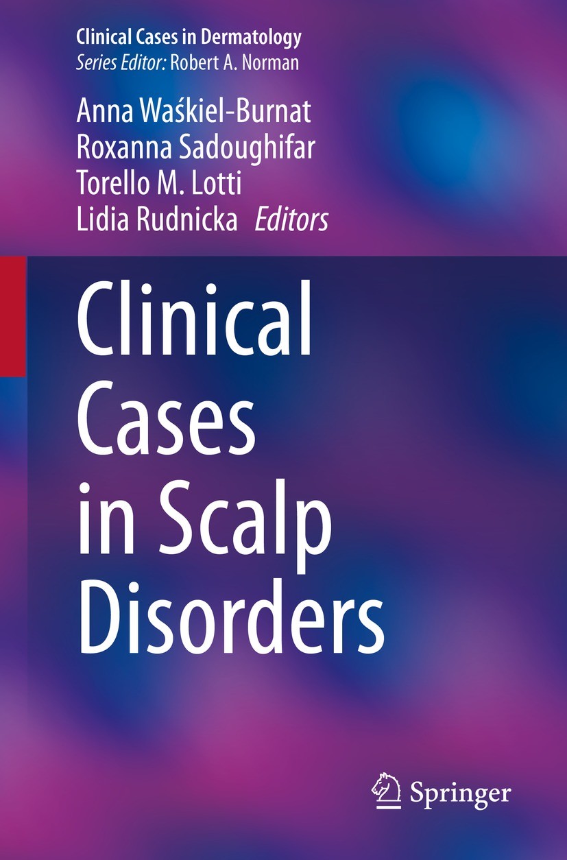 Titlebook: Clinical Cases in Scalp Disorders; Anna Waśkiel-Burnat,Roxanna Sadoughifar,Lidia Rudn Book 2022 The Editor(s) (if applicable) and The Auth Titlebook: Clinical Cases in Scalp Disorders; Anna Waśkiel-Burnat,Roxanna Sadoughifar,Lidia Rudn Book 2022 The Editor(s) (if applicable) and The Auth