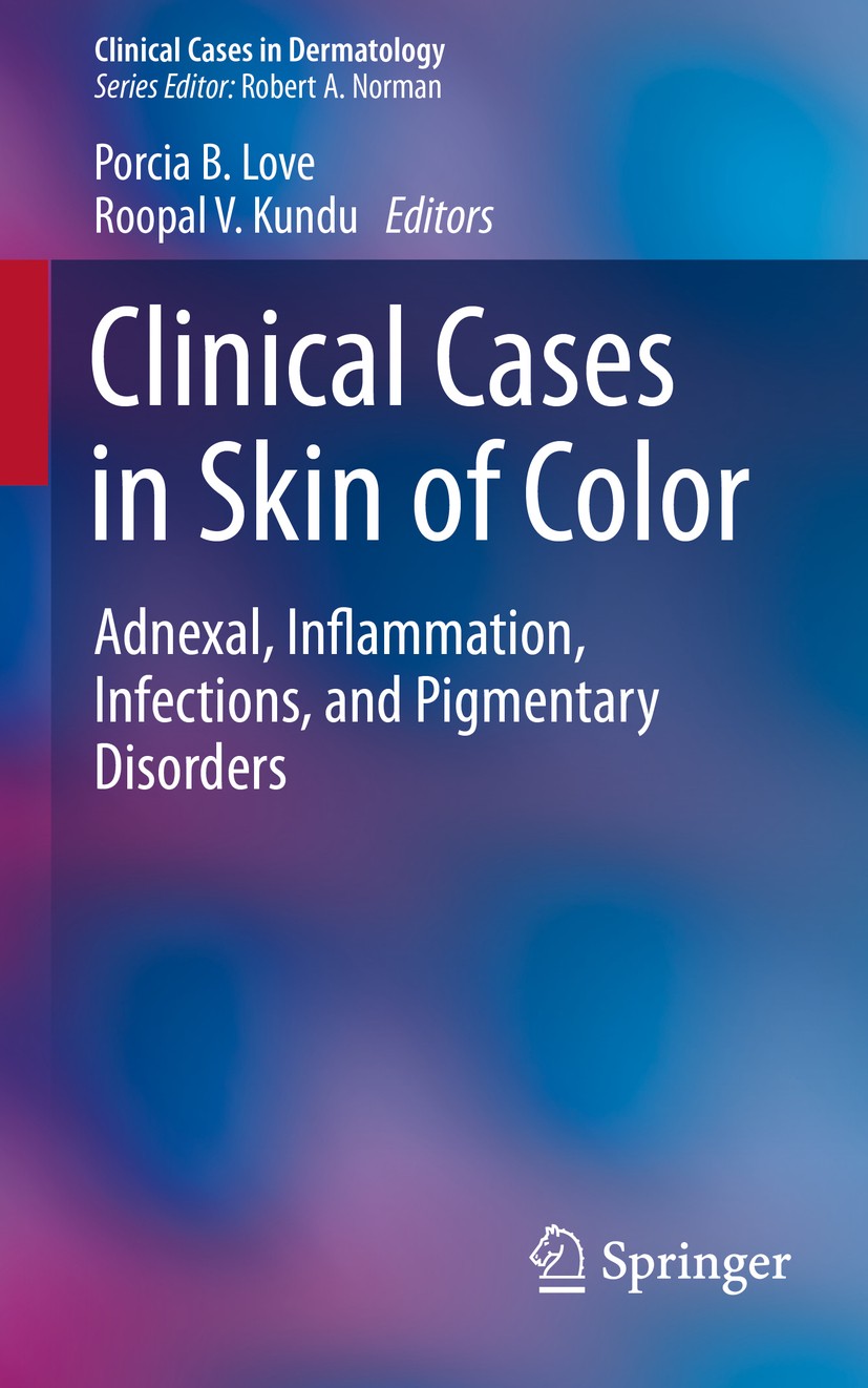 Titlebook: Clinical Cases in Skin of Color; Adnexal, Inflammatio Porcia B. Love,Roopal V. Kundu Book 2016 Springer International Publishing Switzerlan Titlebook: Clinical Cases in Skin of Color; Adnexal, Inflammatio Porcia B. Love,Roopal V. Kundu Book 2016 Springer International Publishing Switzerlan