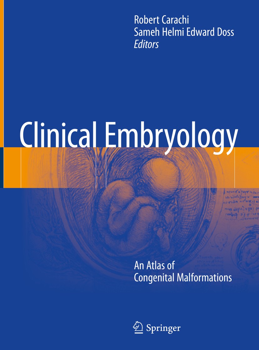 Titlebook: Clinical Embryology; An Atlas of Congenit Robert Carachi,Sameh Helmi Edward Doss Book 2019 Springer International Publishing AG, part of Sp Titlebook: Clinical Embryology; An Atlas of Congenit Robert Carachi,Sameh Helmi Edward Doss Book 2019 Springer International Publishing AG, part of Sp