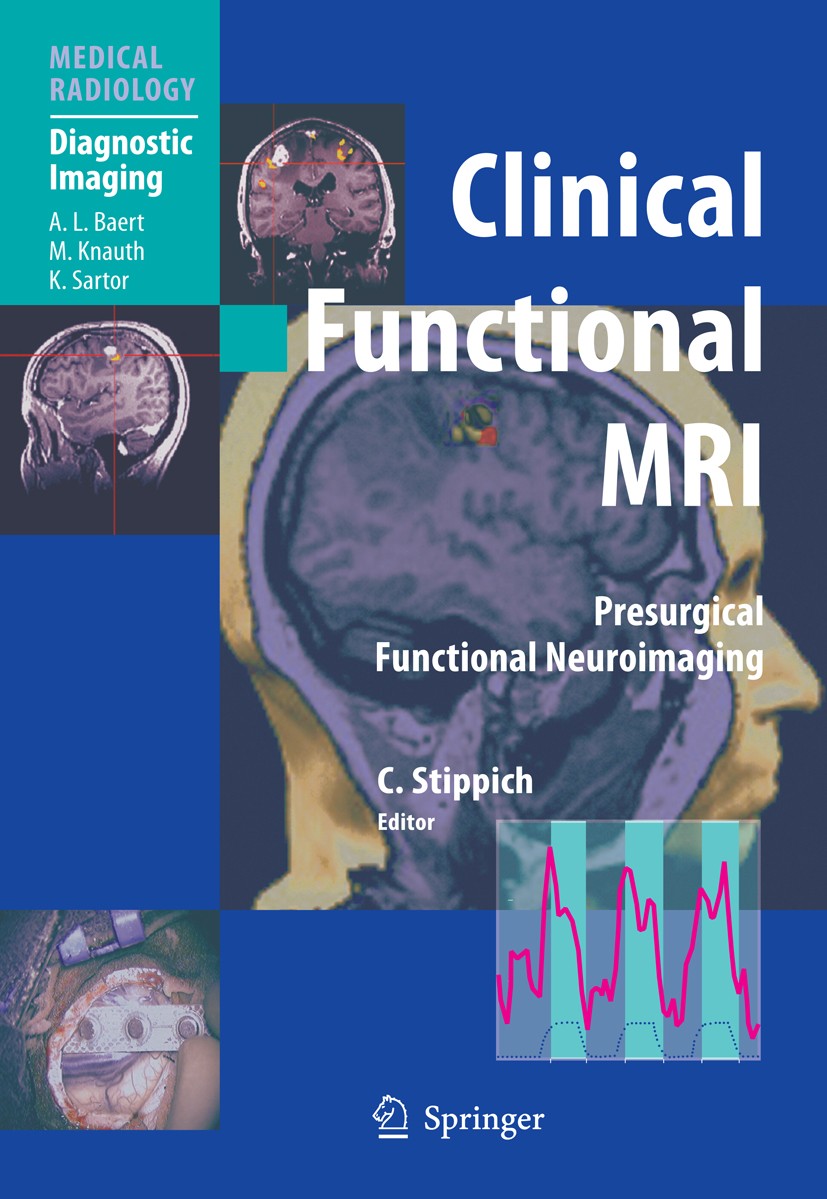 Titlebook: Clinical Functional MRI; Presurgical Function C. Stippich Book 20071st edition The Editor(s) (if applicable) and The Author(s), under exclu Titlebook: Clinical Functional MRI; Presurgical Function C. Stippich Book 20071st edition The Editor(s) (if applicable) and The Author(s), under exclu