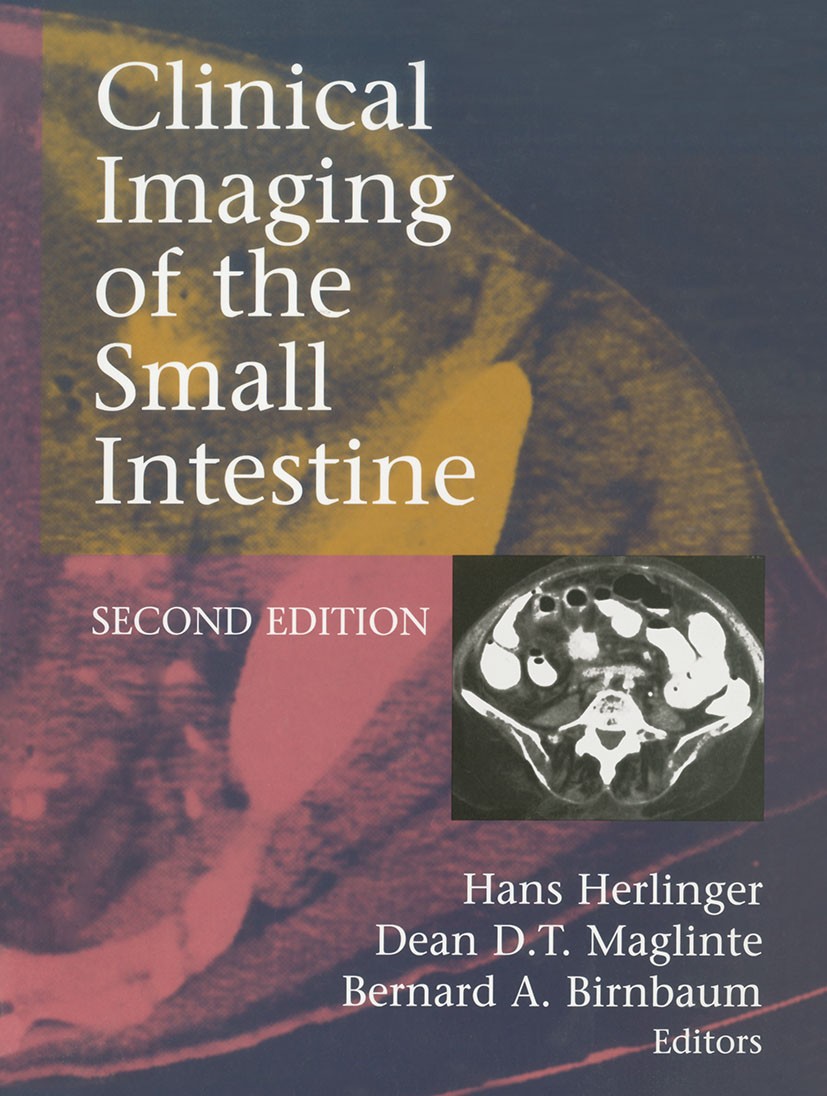 Titlebook: Clinical Imaging of the Small Intestine; Hans Herlinger,Dean D. T. Maglinte,Bernard A. Birn Book 1999Latest edition Springer-Verlag New Yo Titlebook: Clinical Imaging of the Small Intestine; Hans Herlinger,Dean D. T. Maglinte,Bernard A. Birn Book 1999Latest edition Springer-Verlag New Yo