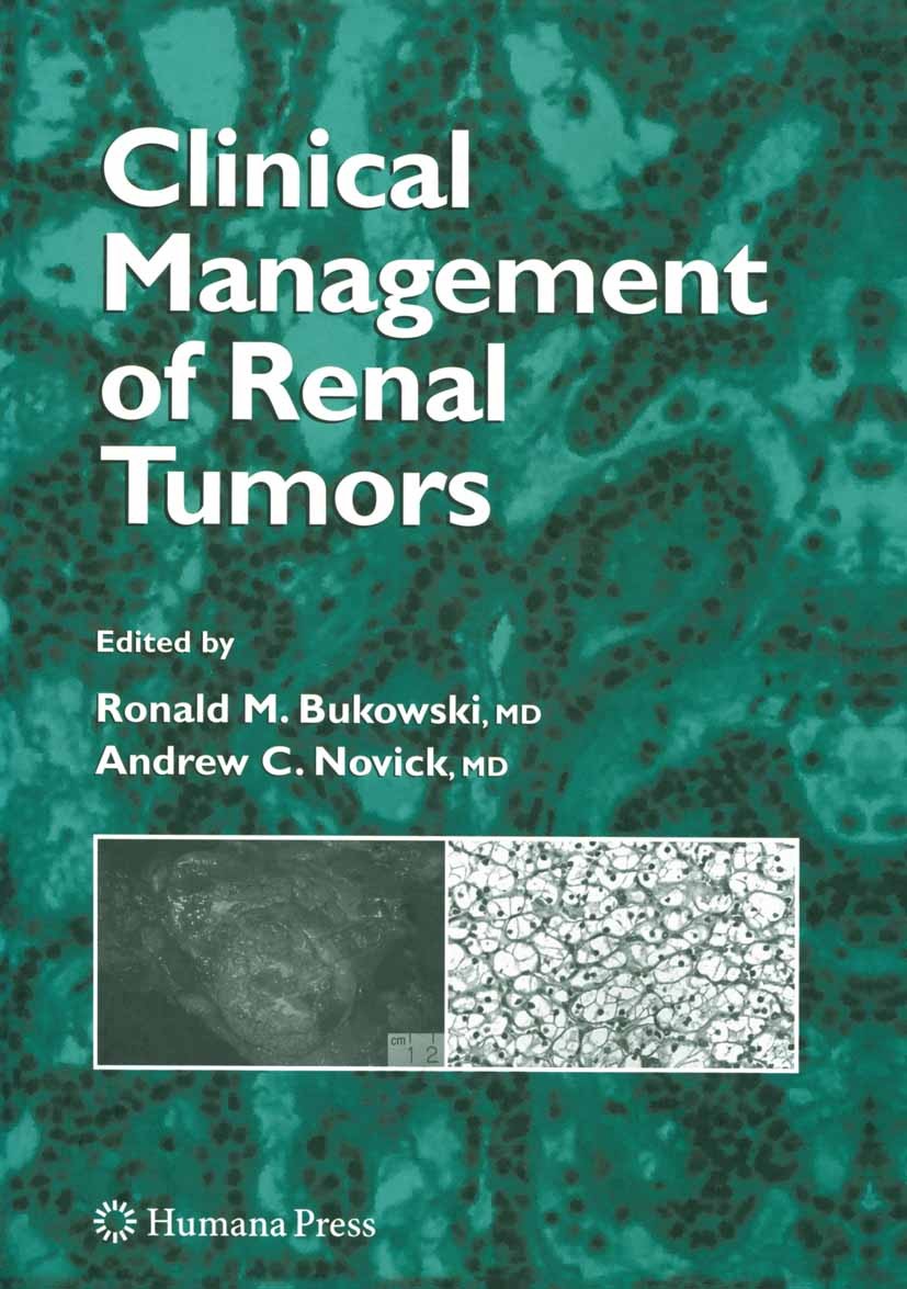 Titlebook: Clinical Management of Renal Tumors; Ronald M. Bukowski,Andrew C. Novick Book 2008 The Editor(s) (if applicable) and The Author(s), under Titlebook: Clinical Management of Renal Tumors; Ronald M. Bukowski,Andrew C. Novick Book 2008 The Editor(s) (if applicable) and The Author(s), under