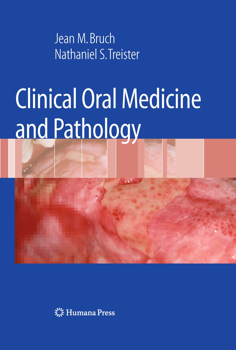 Titlebook: Clinical Oral Medicine and Pathology; Jean M. Bruch,Nathaniel Simon Treister Book 2010 Humana Press 2010 Oral Anatomy.Oral Pathology.Pigme Titlebook: Clinical Oral Medicine and Pathology; Jean M. Bruch,Nathaniel Simon Treister Book 2010 Humana Press 2010 Oral Anatomy.Oral Pathology.Pigme
