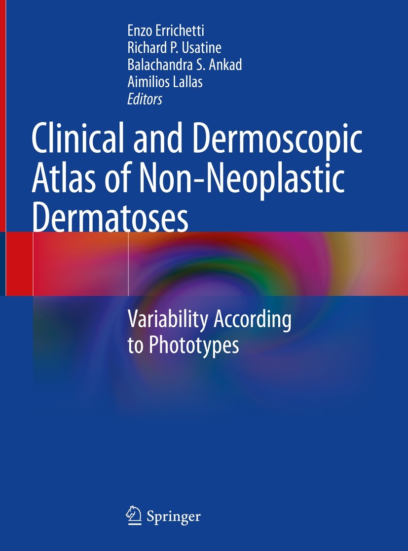 Titlebook: Clinical and Dermoscopic Atlas of Non-Neoplastic Dermatoses; Variability Accordin Enzo Errichetti,Richard P. Usatine,Aimilios Lallas Book 2 Titlebook: Clinical and Dermoscopic Atlas of Non-Neoplastic Dermatoses; Variability Accordin Enzo Errichetti,Richard P. Usatine,Aimilios Lallas Book 2