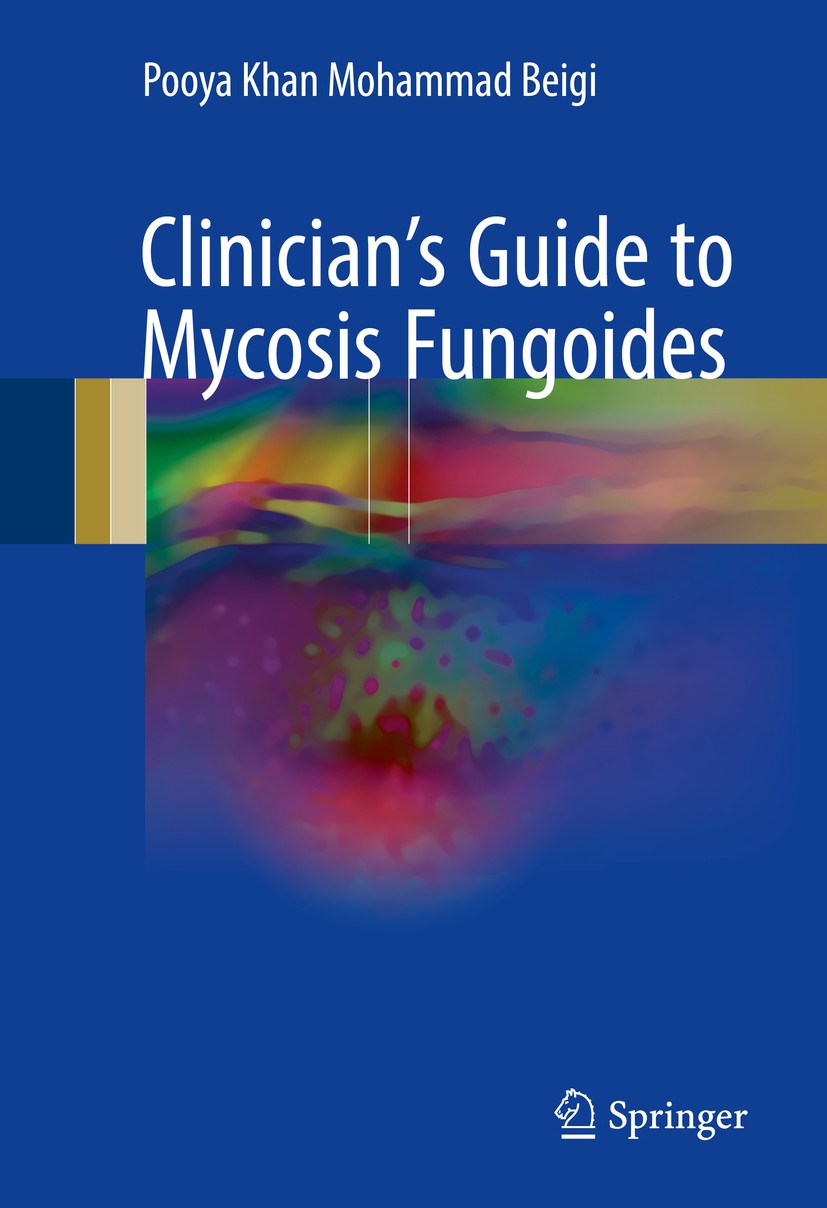 Titlebook: Clinician‘s Guide to Mycosis Fungoides; Pooya Khan Mohammad Beigi Book 2017 Springer International Publishing AG 2017 mycosis fungoides.sk Titlebook: Clinician‘s Guide to Mycosis Fungoides; Pooya Khan Mohammad Beigi Book 2017 Springer International Publishing AG 2017 mycosis fungoides.sk