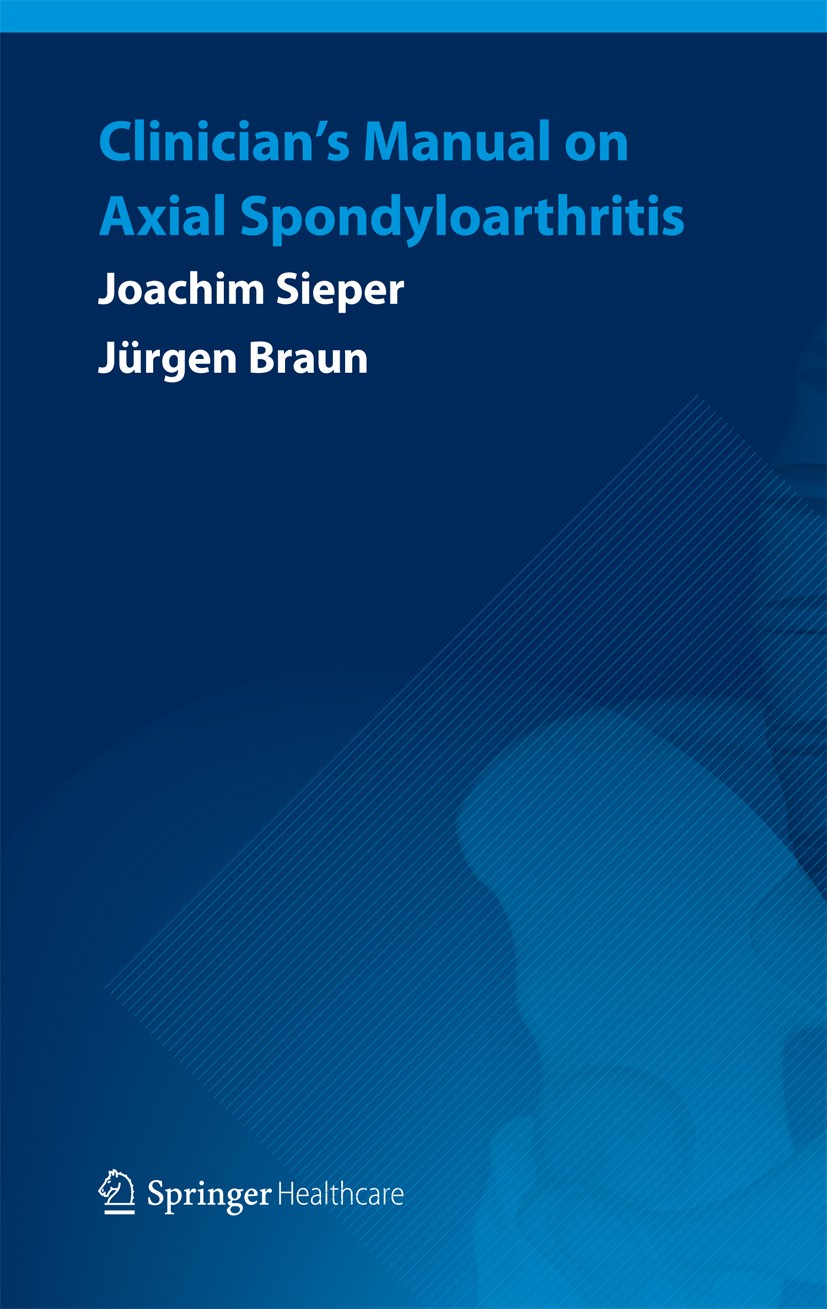 Titlebook: Clinician’s Manual on Axial Spondyloarthritis; Joachim Sieper,Jürgen Braun Book 2014 Springer Healthcare 2014 Ankylosing spondylitis.Axial Titlebook: Clinician’s Manual on Axial Spondyloarthritis; Joachim Sieper,Jürgen Braun Book 2014 Springer Healthcare 2014 Ankylosing spondylitis.Axial
