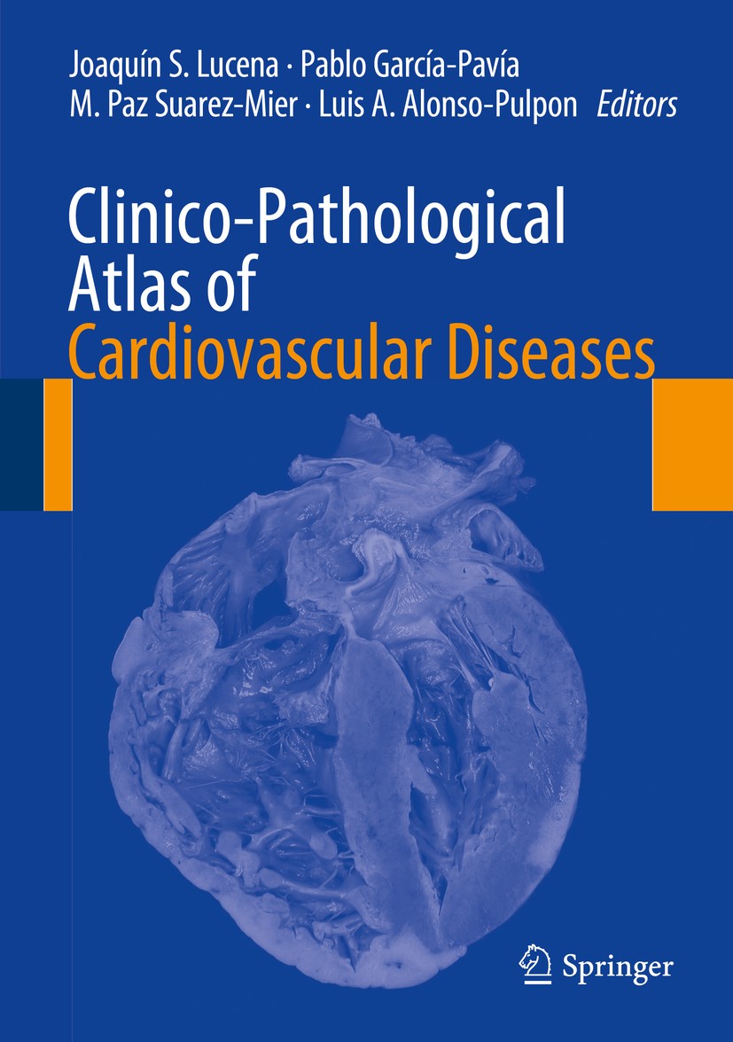 Titlebook: Clinico-Pathological Atlas of Cardiovascular Diseases; Joaquín S. Lucena,Pablo García-Pavía,Luis A. Alons Book 2015 Springer International Titlebook: Clinico-Pathological Atlas of Cardiovascular Diseases; Joaquín S. Lucena,Pablo García-Pavía,Luis A. Alons Book 2015 Springer International