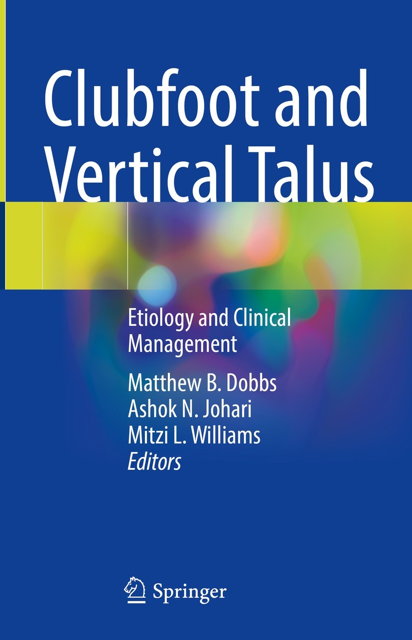 Titlebook: Clubfoot and Vertical Talus; Etiology and Clinica Matthew B. Dobbs,Ashok N. Johari,Mitzi L. Williams Book 2023 The Editor(s) (if applicable Titlebook: Clubfoot and Vertical Talus; Etiology and Clinica Matthew B. Dobbs,Ashok N. Johari,Mitzi L. Williams Book 2023 The Editor(s) (if applicable