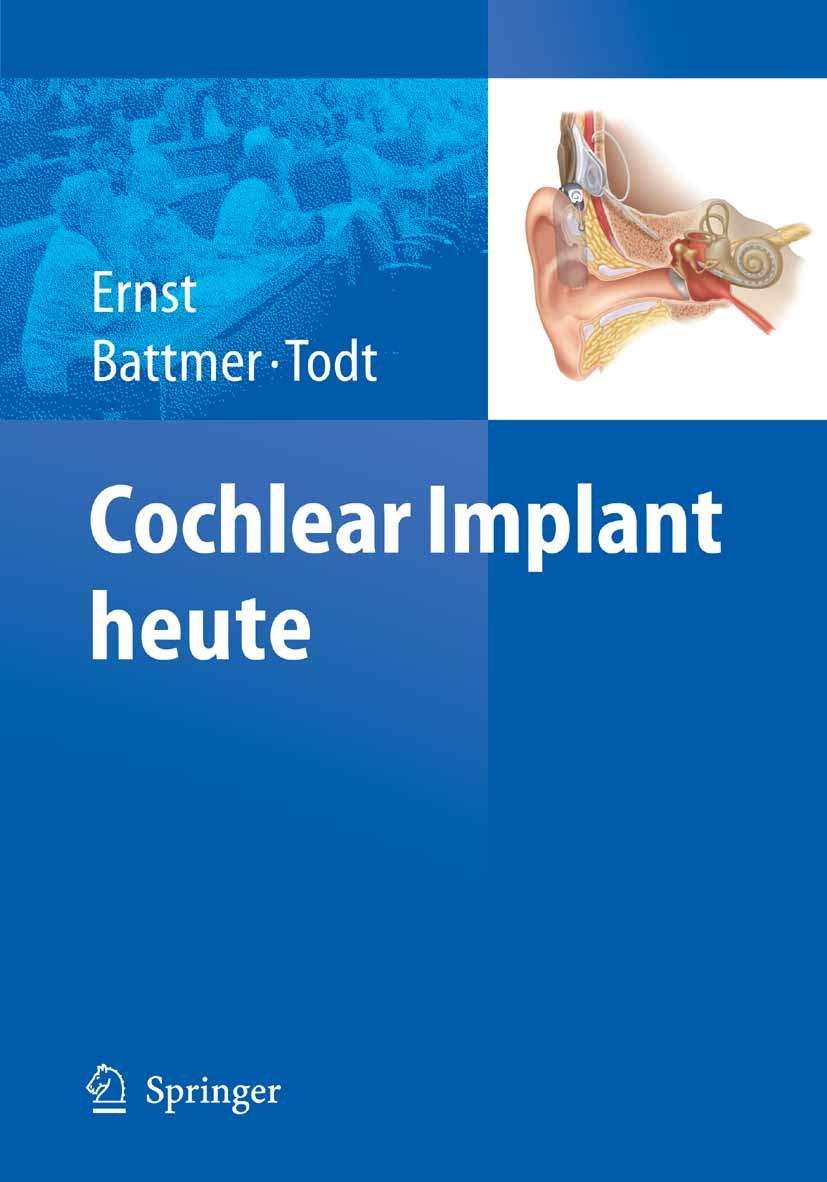 Titlebook: Cochlear Implant heute; Arneborg Ernst,Rolf-Dieter Battmer,Ingo Todt Conference proceedings 2009 Springer-Verlag Berlin Heidelberg 2009 CI Titlebook: Cochlear Implant heute; Arneborg Ernst,Rolf-Dieter Battmer,Ingo Todt Conference proceedings 2009 Springer-Verlag Berlin Heidelberg 2009 CI