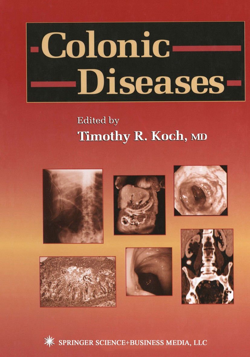 Titlebook: Colonic Diseases; Timothy R. Koch Book 2003 Springer Science+Business Media New York 2003 biopsy.cancer.colon.colorectal cancer.gastrointe Titlebook: Colonic Diseases; Timothy R. Koch Book 2003 Springer Science+Business Media New York 2003 biopsy.cancer.colon.colorectal cancer.gastrointe