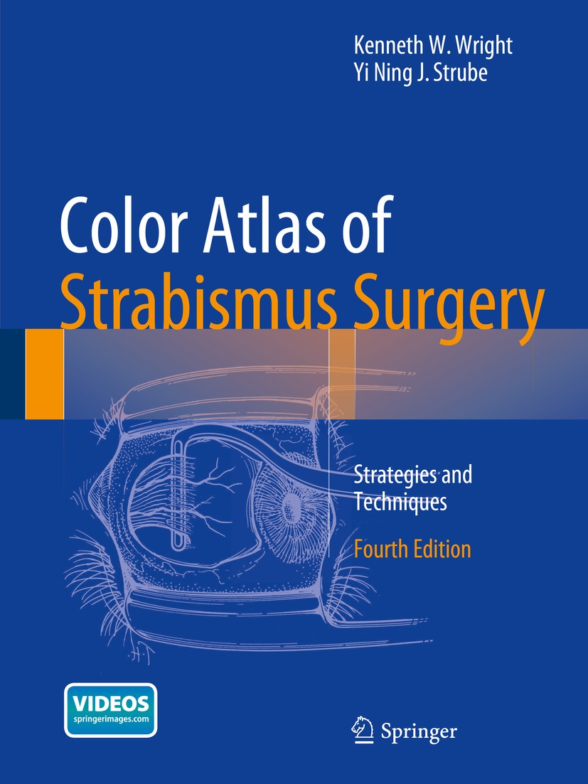 Titlebook: Color Atlas Of Strabismus Surgery; Strategies and Techn Kenneth W. Wright,Yi Ning J. Strube Book 2015Latest edition Springer Science+Busine Titlebook: Color Atlas Of Strabismus Surgery; Strategies and Techn Kenneth W. Wright,Yi Ning J. Strube Book 2015Latest edition Springer Science+Busine