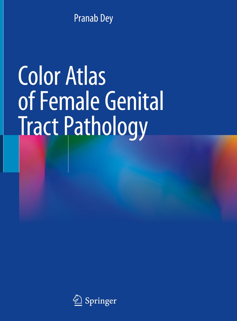 Titlebook: Color Atlas of Female Genital Tract Pathology; Pranab Dey Book 2019 Springer Nature Singapore Pte Ltd. 2019 Tumors of female genital tract Titlebook: Color Atlas of Female Genital Tract Pathology; Pranab Dey Book 2019 Springer Nature Singapore Pte Ltd. 2019 Tumors of female genital tract