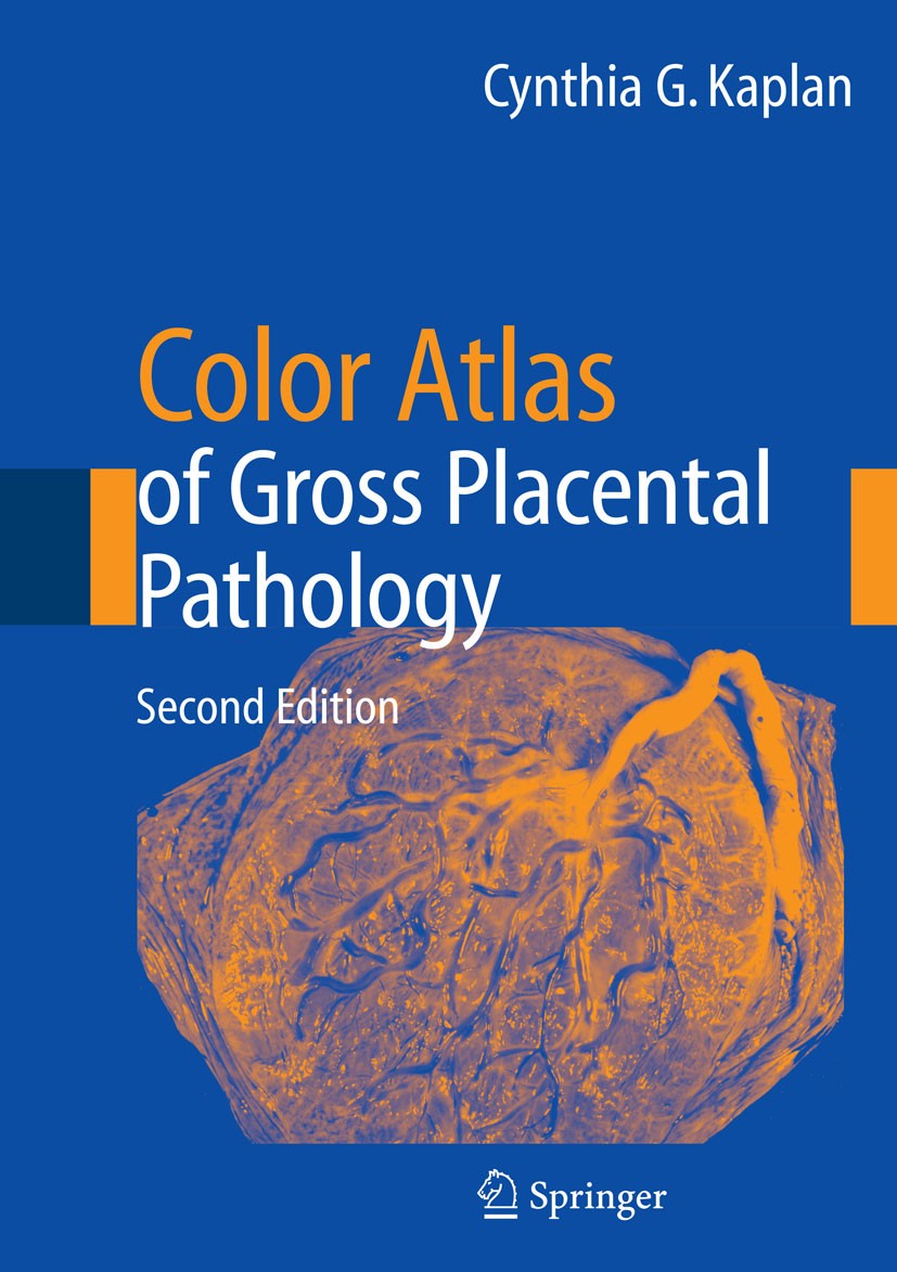 Titlebook: Color Atlas of Gross Placental Pathology; Cynthia G. Kaplan Book 2007Latest edition Springer-Verlag New York 2007 anatomy.fetus.placenta.p Titlebook: Color Atlas of Gross Placental Pathology; Cynthia G. Kaplan Book 2007Latest edition Springer-Verlag New York 2007 anatomy.fetus.placenta.p
