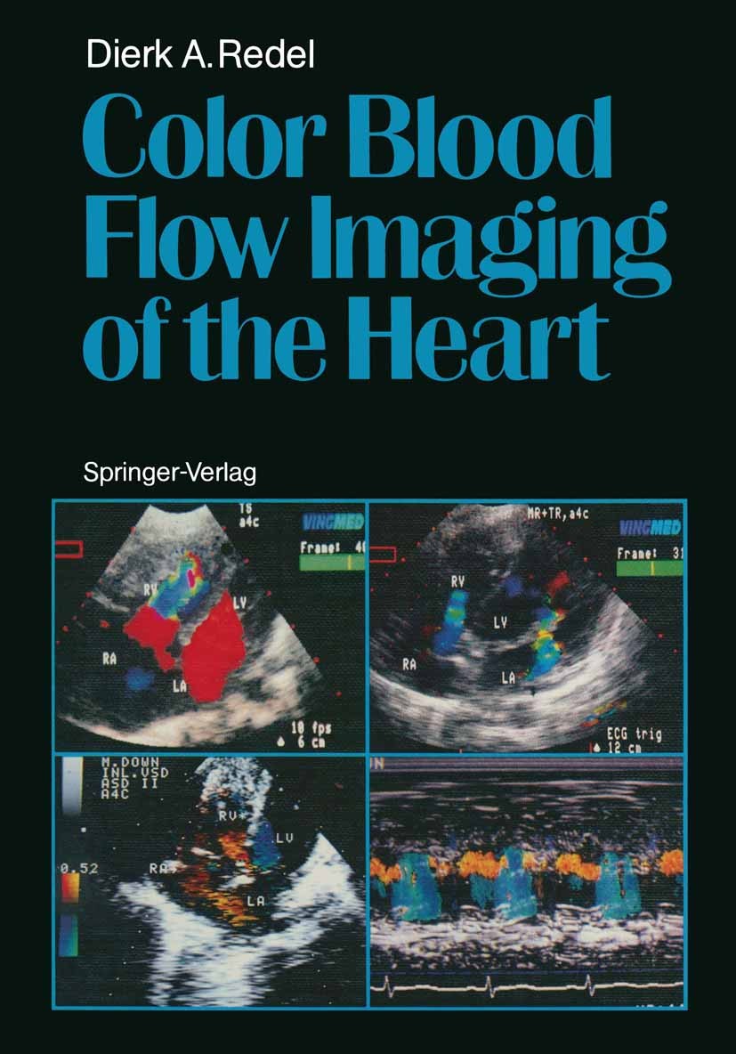Titlebook: Color Blood Flow Imaging of the Heart; Dierk A. Redel Book 1988 Springer-Verlag Berlin Heidelberg 1988 cardiology.cardiovascular.cardiovas Titlebook: Color Blood Flow Imaging of the Heart; Dierk A. Redel Book 1988 Springer-Verlag Berlin Heidelberg 1988 cardiology.cardiovascular.cardiovas