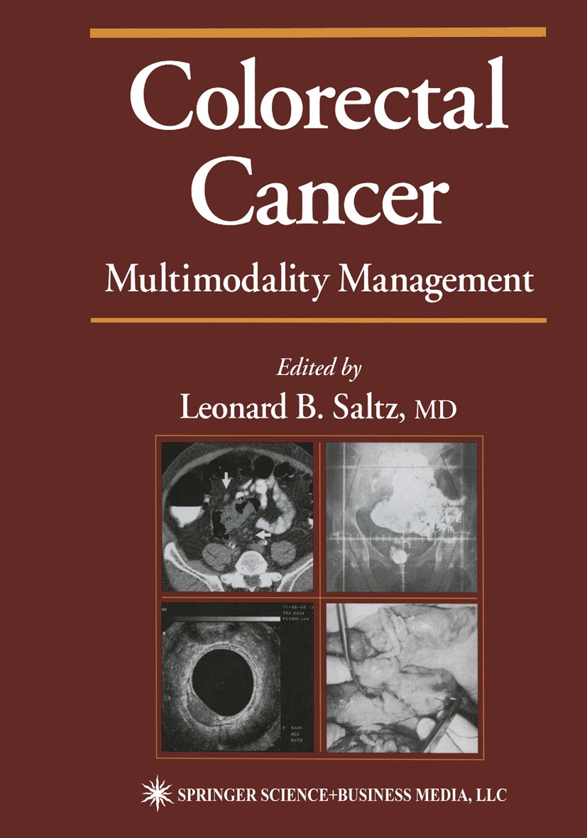 Titlebook: Colorectal Cancer; Multimodality Manage Leonard B. Saltz Book 2002 Humana Press 2002 CT.Cancer Screening.Staging.adjuvant therapy.carcinoge Titlebook: Colorectal Cancer; Multimodality Manage Leonard B. Saltz Book 2002 Humana Press 2002 CT.Cancer Screening.Staging.adjuvant therapy.carcinoge