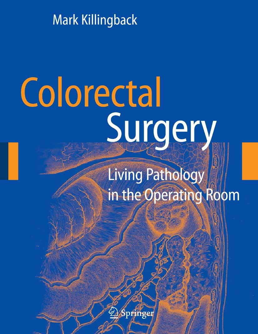 Titlebook: Colorectal Surgery; Living Pathology in Mark Killingback Book 2006 Springer-Verlag New York 2006 Surgery.colorectal pathology.colorectal s Titlebook: Colorectal Surgery; Living Pathology in Mark Killingback Book 2006 Springer-Verlag New York 2006 Surgery.colorectal pathology.colorectal s