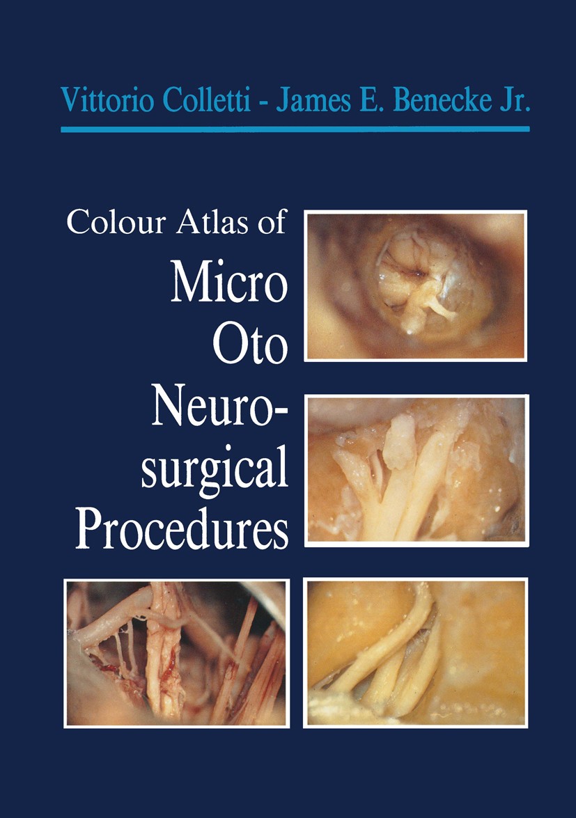 Titlebook: Colour Atlas of Micro-Oto-Neurosurgical Procedures; Vittorio Colletti,James E. Benecke Book 1989 Springer-Verlag London 1989 Otoneurologie Titlebook: Colour Atlas of Micro-Oto-Neurosurgical Procedures; Vittorio Colletti,James E. Benecke Book 1989 Springer-Verlag London 1989 Otoneurologie