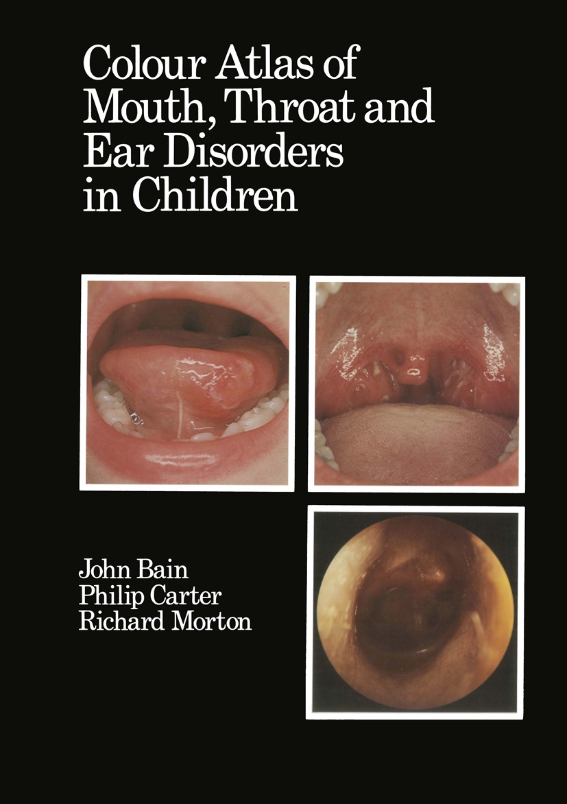 Titlebook: Colour Atlas of Mouth, Throat and Ear Disorders in Children; John Bain,Philip Carter,Richard Morton Book 1985 J. Bain, P. Carter and R. Mo Titlebook: Colour Atlas of Mouth, Throat and Ear Disorders in Children; John Bain,Philip Carter,Richard Morton Book 1985 J. Bain, P. Carter and R. Mo