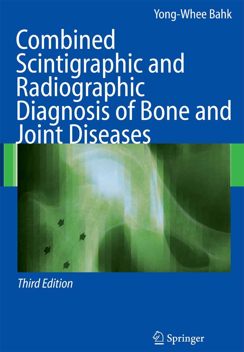 Titlebook: Combined Scintigraphic and Radiographic Diagnosis of Bone and Joint Diseases; Yong-Whee Bahk Book 20073rd edition Springer-Verlag Berlin H Titlebook: Combined Scintigraphic and Radiographic Diagnosis of Bone and Joint Diseases; Yong-Whee Bahk Book 20073rd edition Springer-Verlag Berlin H