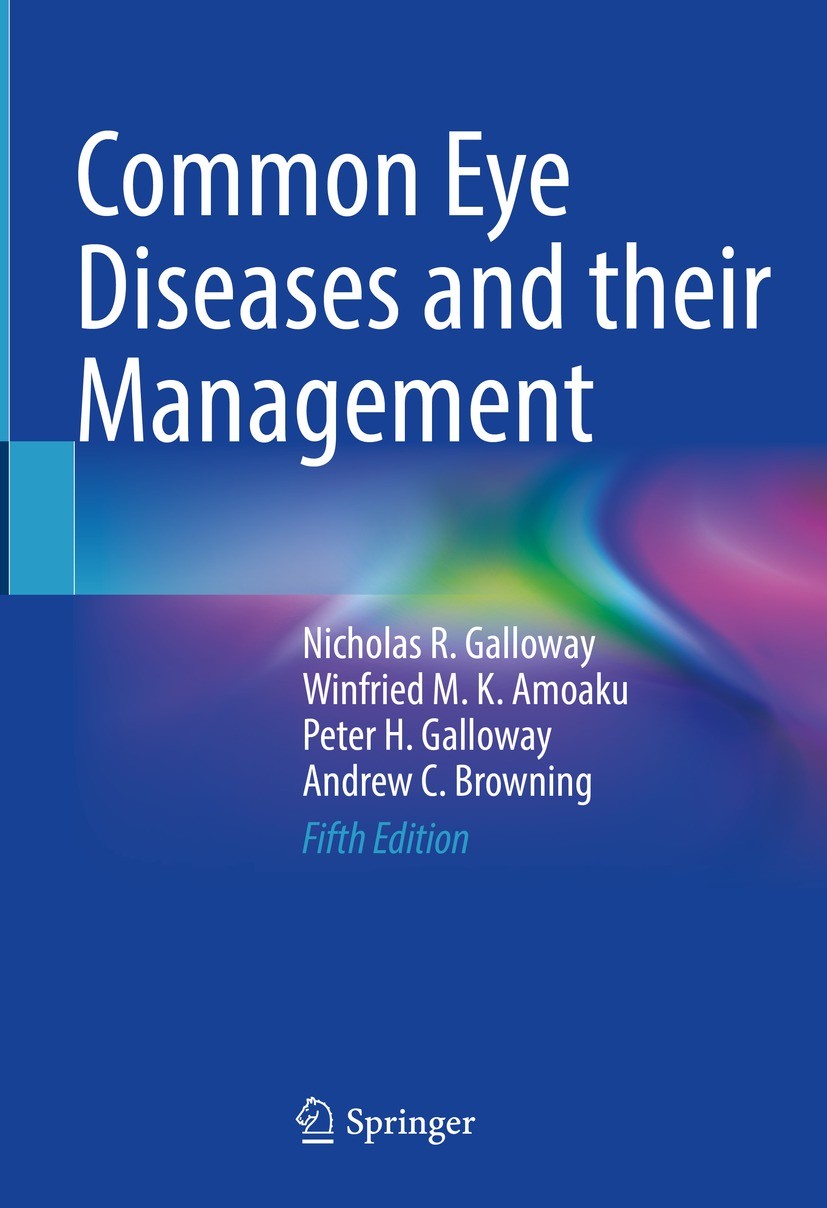Titlebook: Common Eye Diseases and their Management; Nicholas R. Galloway,Winfried M. K. Amoaku,Andrew Textbook 2022Latest edition The Editor(s) (if Titlebook: Common Eye Diseases and their Management; Nicholas R. Galloway,Winfried M. K. Amoaku,Andrew Textbook 2022Latest edition The Editor(s) (if