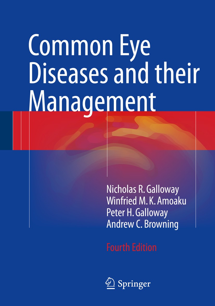 Titlebook: Common Eye Diseases and their Management; Nicholas R. Galloway,Winfried M. K. Amoaku,Andrew Textbook 20164th edition Springer Internation Titlebook: Common Eye Diseases and their Management; Nicholas R. Galloway,Winfried M. K. Amoaku,Andrew Textbook 20164th edition Springer Internation