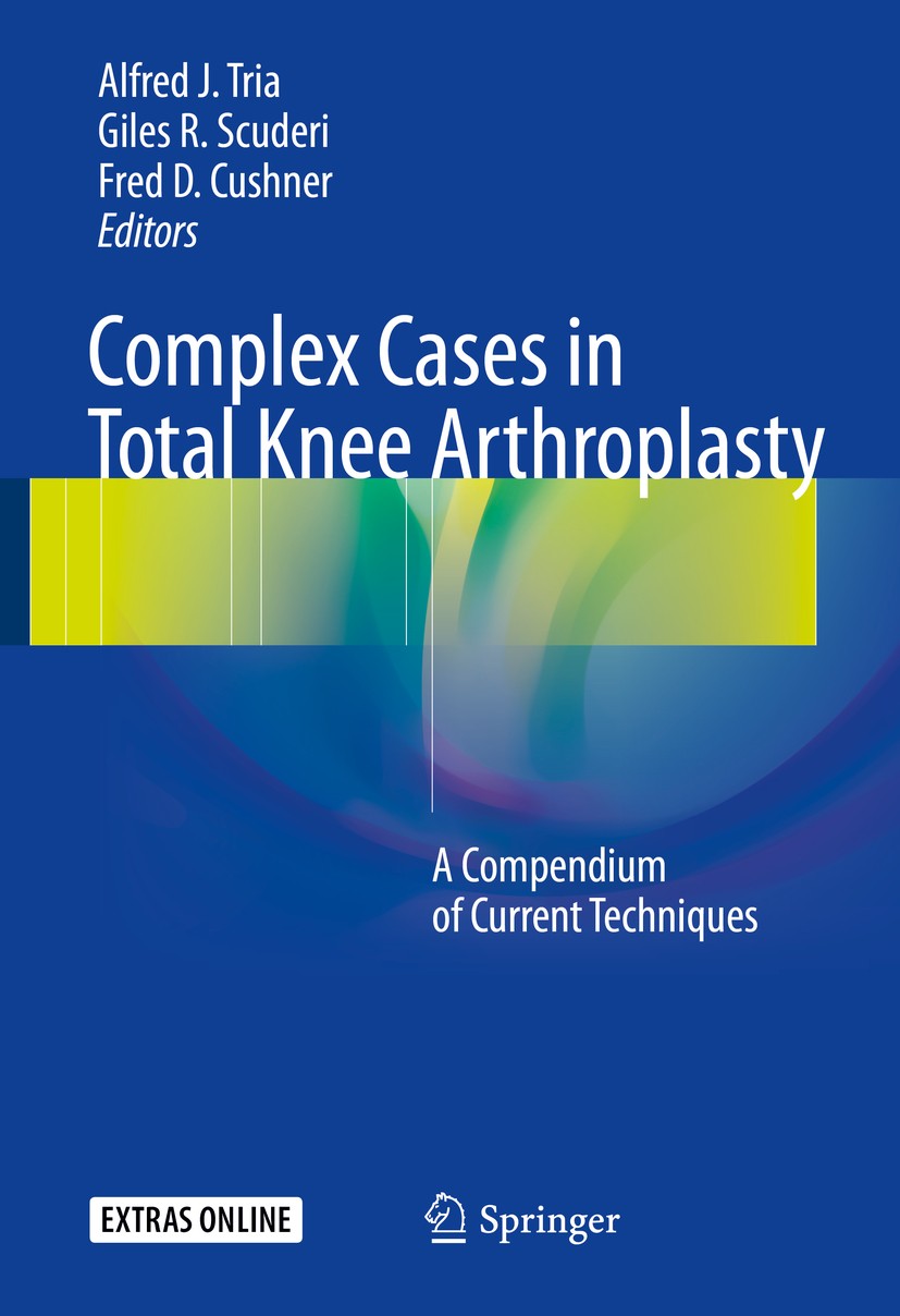 Titlebook: Complex Cases in Total Knee Arthroplasty; A Compendium of Curr Alfred J. Tria,Giles R. Scuderi,Fred D. Cushner Book 2018 Springer Internati Titlebook: Complex Cases in Total Knee Arthroplasty; A Compendium of Curr Alfred J. Tria,Giles R. Scuderi,Fred D. Cushner Book 2018 Springer Internati