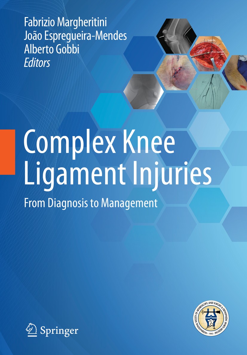 Titlebook: Complex Knee Ligament Injuries; From Diagnosis to Ma Fabrizio Margheritini,João Espregueira-Mendes,Albe Book 2019 Springer-Verlag GmbH Germ Titlebook: Complex Knee Ligament Injuries; From Diagnosis to Ma Fabrizio Margheritini,João Espregueira-Mendes,Albe Book 2019 Springer-Verlag GmbH Germ