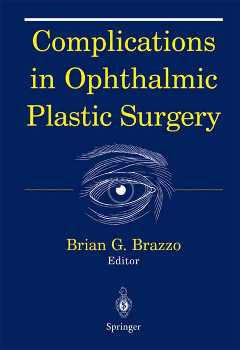 Titlebook: Complications in Ophthalmic Plastic Surgery; Brian G. Brazzo (Clinical Assistant Professor of O Book 2003 Springer Science+Business Media Titlebook: Complications in Ophthalmic Plastic Surgery; Brian G. Brazzo (Clinical Assistant Professor of O Book 2003 Springer Science+Business Media