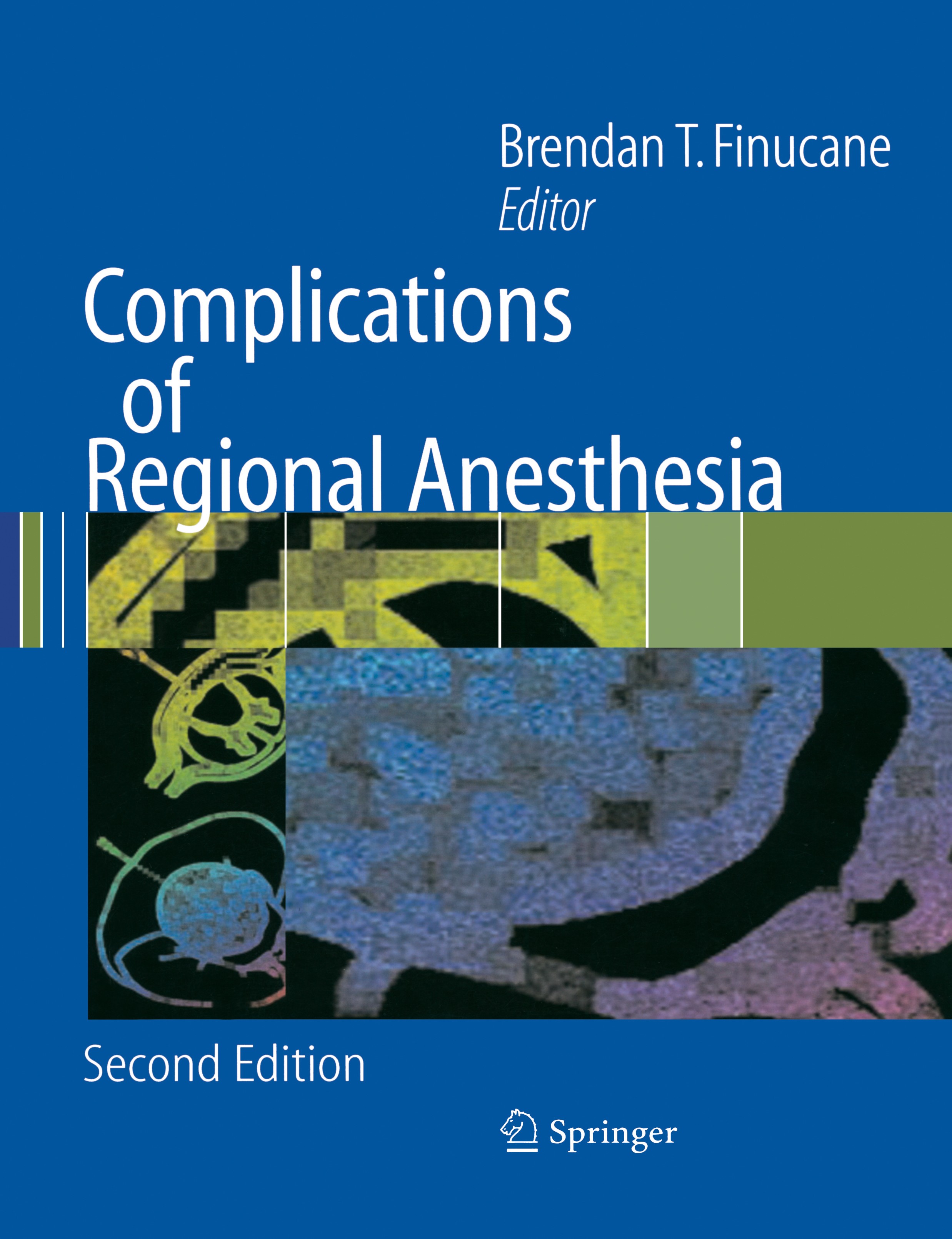 Titlebook: Complications of Regional Anesthesia; Brendan T. Finucane (Professor) Book 20072nd edition Springer-Verlag New York 2007 anesthesiology.ca Titlebook: Complications of Regional Anesthesia; Brendan T. Finucane (Professor) Book 20072nd edition Springer-Verlag New York 2007 anesthesiology.ca