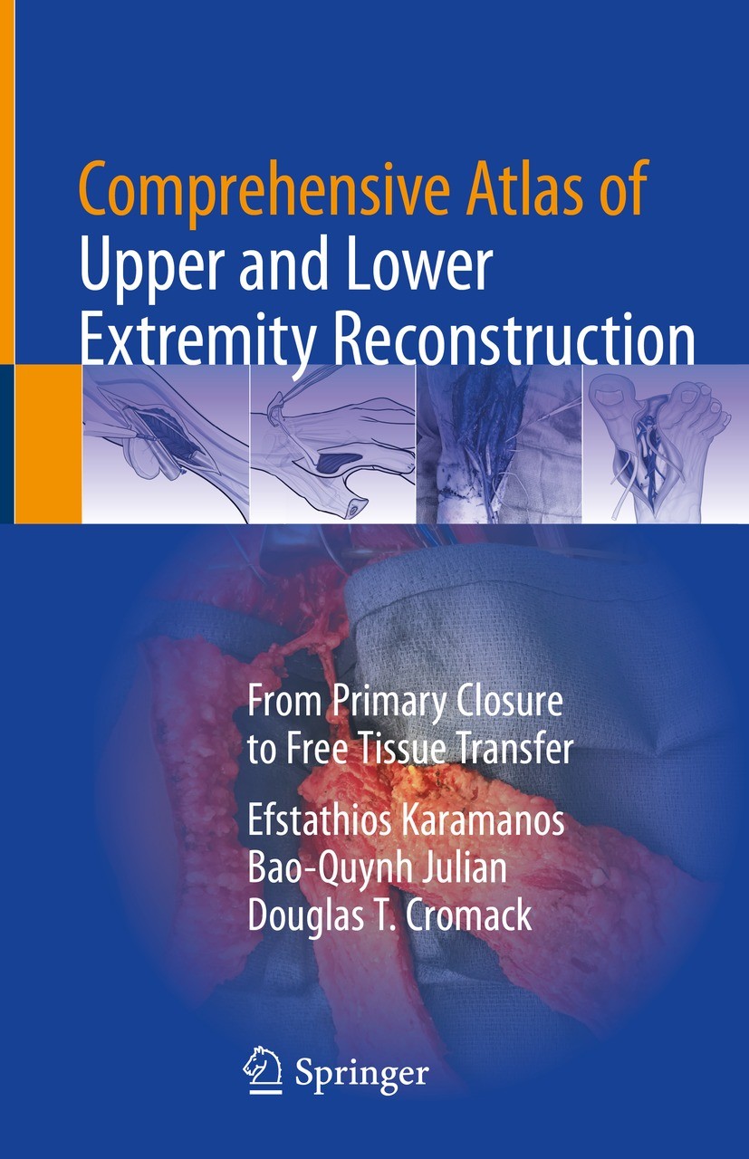 Titlebook: Comprehensive Atlas of Upper and Lower Extremity Reconstruction; From Primary Closure Efstathios Karamanos,Bao-Quynh Julian,Douglas T. C Bo Titlebook: Comprehensive Atlas of Upper and Lower Extremity Reconstruction; From Primary Closure Efstathios Karamanos,Bao-Quynh Julian,Douglas T. C Bo