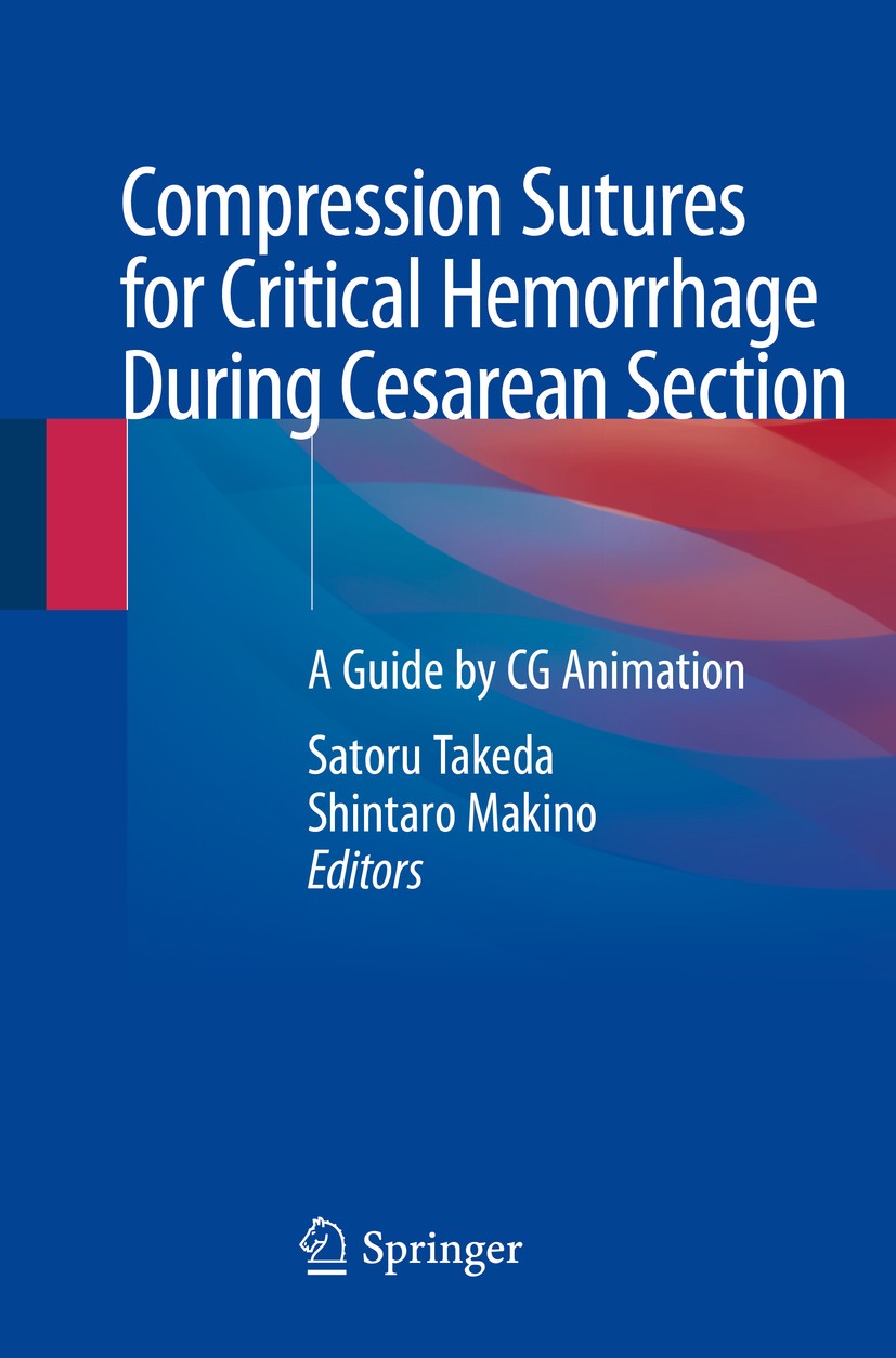Titlebook: Compression Sutures for Critical Hemorrhage During Cesarean Section; A Guide by CG Animat Satoru Takeda,Shintaro Makino Book 2020 Springer Titlebook: Compression Sutures for Critical Hemorrhage During Cesarean Section; A Guide by CG Animat Satoru Takeda,Shintaro Makino Book 2020 Springer
