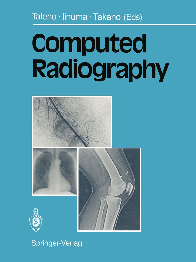 Titlebook: Computed Radiography; Yukio Tateno,Takeshi Iinuma,Masao Takano Book 1987 Springer Japan 1987 X-ray.angiography.children.diseases.evaluatio Titlebook: Computed Radiography; Yukio Tateno,Takeshi Iinuma,Masao Takano Book 1987 Springer Japan 1987 X-ray.angiography.children.diseases.evaluatio