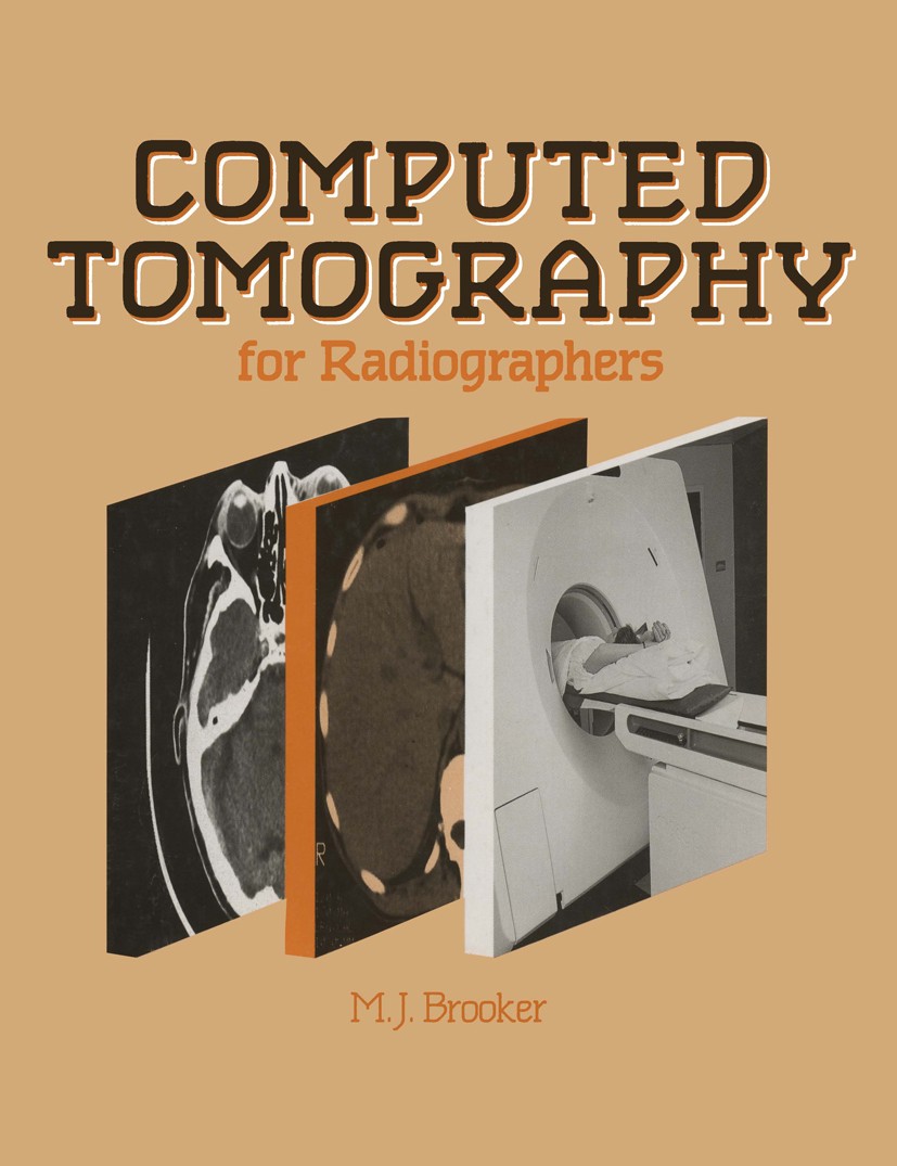 Titlebook: Computed Tomography for Radiographers; Malcolm J. Brooker Book 1986 MTP Press Limited 1986 computed tomography (CT).tomography Titlebook: Computed Tomography for Radiographers; Malcolm J. Brooker Book 1986 MTP Press Limited 1986 computed tomography (CT).tomography