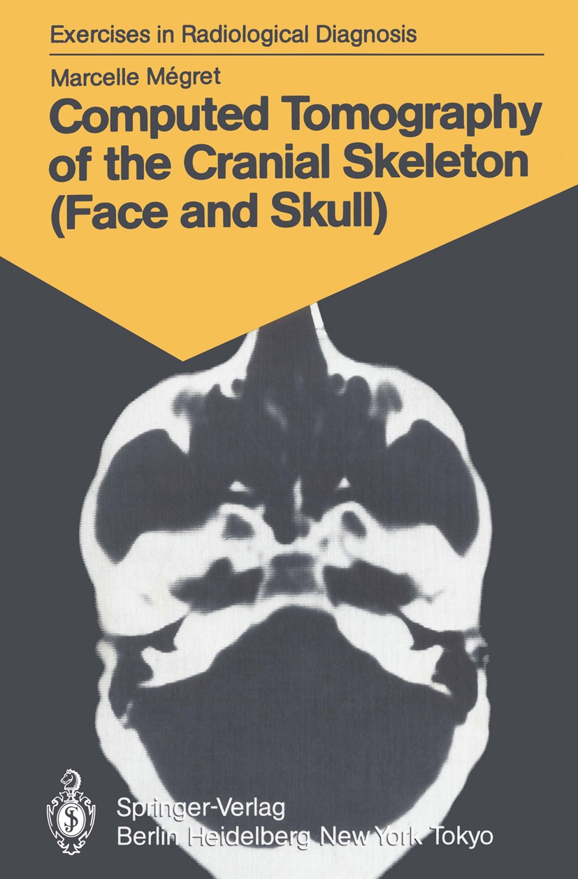 Titlebook: Computed Tomography of the Cranial Skeleton (Face and Skull); 58 Radiological Exer Marcelle Mégret Book 1986 Springer-Verlag Berlin Heidelb Titlebook: Computed Tomography of the Cranial Skeleton (Face and Skull); 58 Radiological Exer Marcelle Mégret Book 1986 Springer-Verlag Berlin Heidelb