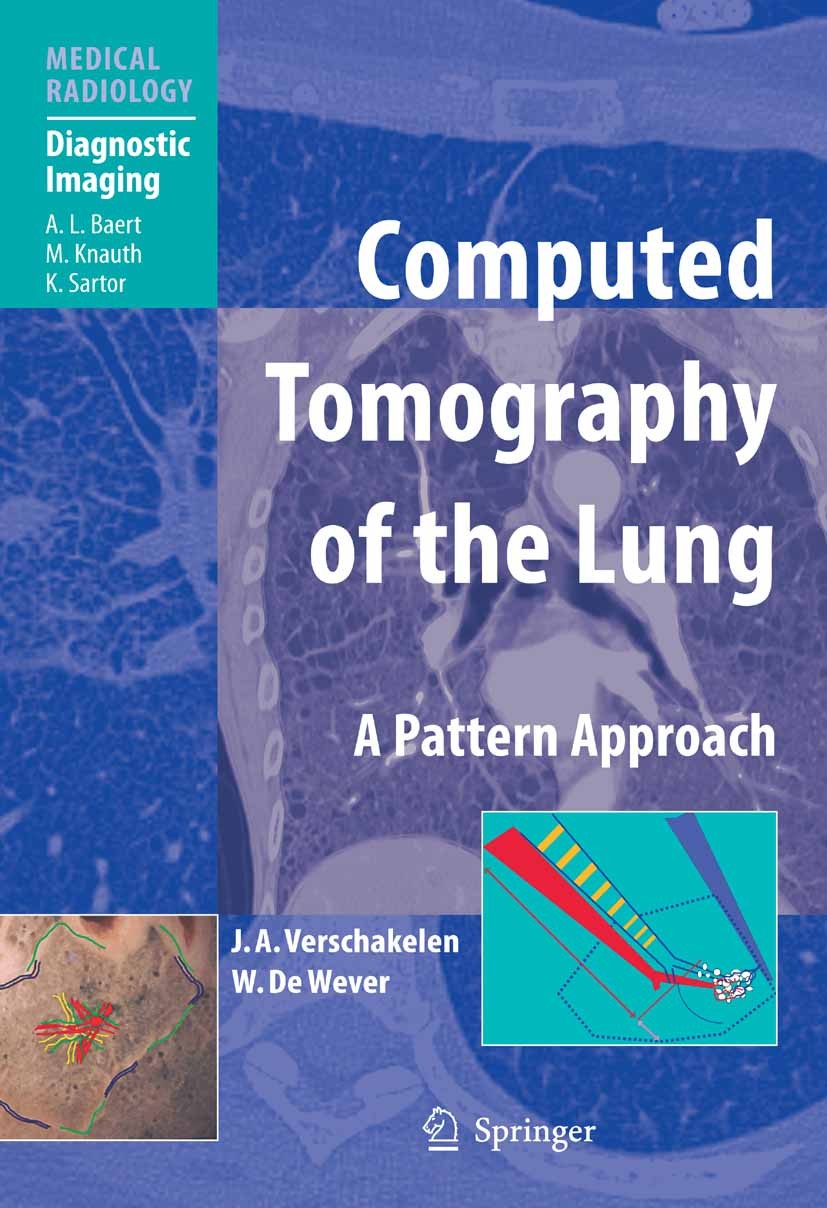 Titlebook: Computed Tomography of the Lung; A Pattern Approach J. A. Verschakelen,W. Wever Book 20071st edition Springer-Verlag Berlin Heidelberg 2007 Titlebook: Computed Tomography of the Lung; A Pattern Approach J. A. Verschakelen,W. Wever Book 20071st edition Springer-Verlag Berlin Heidelberg 2007