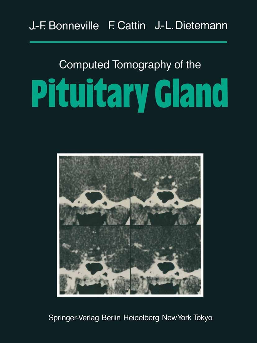 Titlebook: Computed Tomography of the Pituitary Gland; With a Chapter on Ma Jean-François Bonneville,Françoise Cattin,Jean-Lou Book 1986 Springer-Verl Titlebook: Computed Tomography of the Pituitary Gland; With a Chapter on Ma Jean-François Bonneville,Françoise Cattin,Jean-Lou Book 1986 Springer-Verl