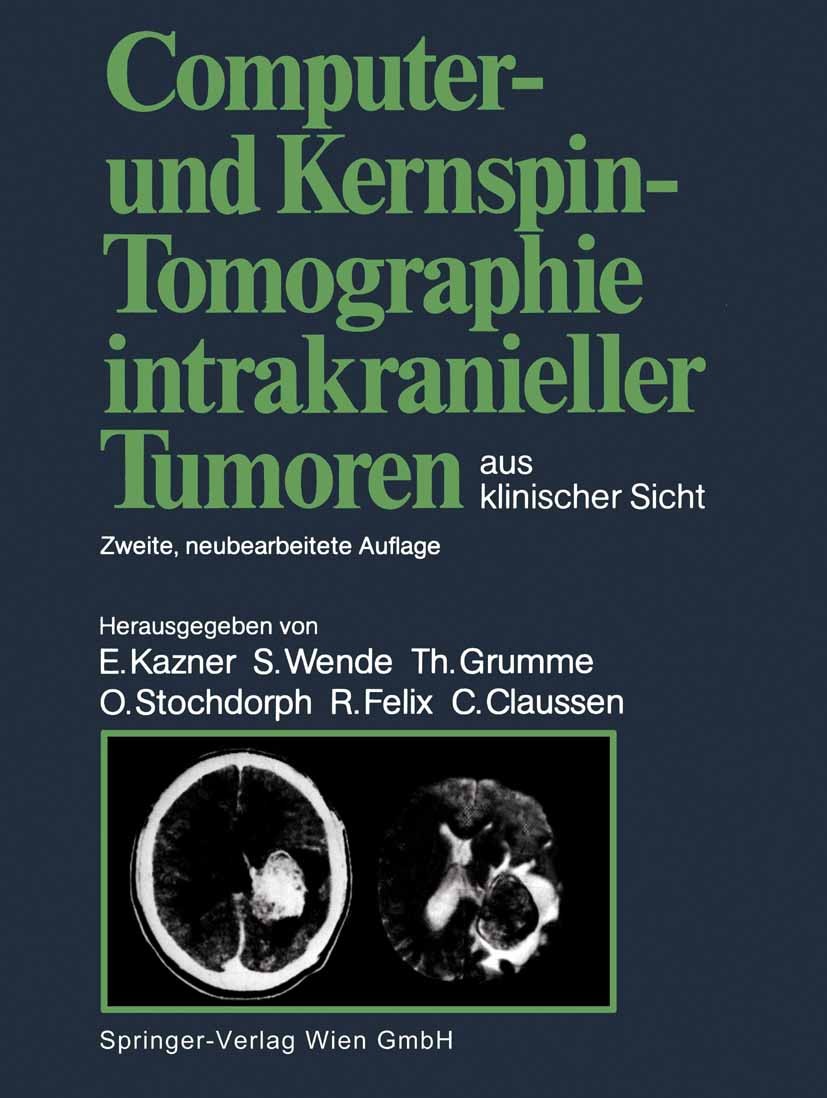 Titlebook: Computer- und Kernspin-Tomographie intrakranieller Tumoren aus klinischer Sicht; Claus Claussen (Oberarzt),Rudolf Fahlbusch (Direkt Book 1 Titlebook: Computer- und Kernspin-Tomographie intrakranieller Tumoren aus klinischer Sicht; Claus Claussen (Oberarzt),Rudolf Fahlbusch (Direkt Book 1