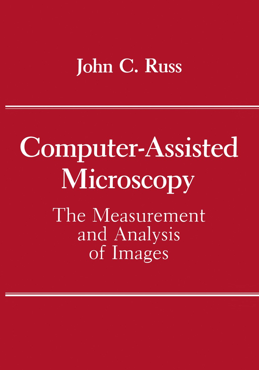 Titlebook: Computer-Assisted Microscopy; The Measurement and John C. Russ Book 1990 Plenum Press, New York 1990 algorithms.computer system.image anal Titlebook: Computer-Assisted Microscopy; The Measurement and John C. Russ Book 1990 Plenum Press, New York 1990 algorithms.computer system.image anal