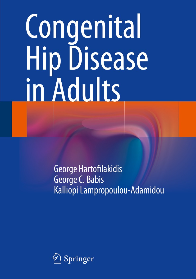 Titlebook: Congenital Hip Disease in Adults; George Hartofilakidis,George C. Babis,Kalliopi Lam Book 2014 Springer-Verlag Italia 2014 Cotyloplasty.Di Titlebook: Congenital Hip Disease in Adults; George Hartofilakidis,George C. Babis,Kalliopi Lam Book 2014 Springer-Verlag Italia 2014 Cotyloplasty.Di