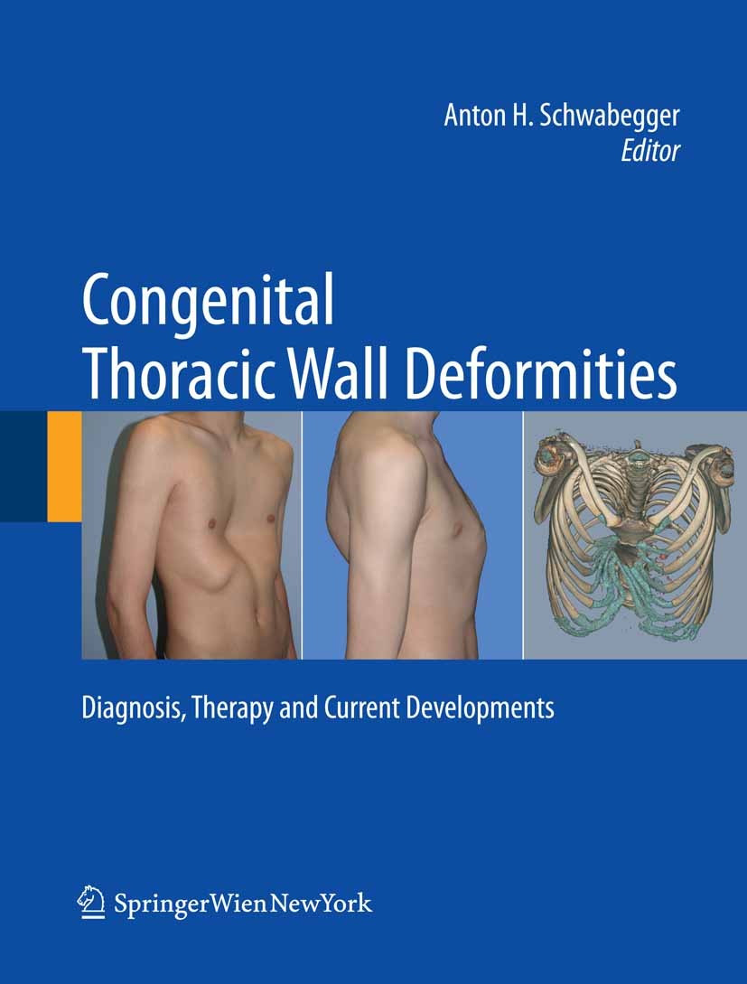 Titlebook: Congenital Thoracic Wall Deformities; Diagnosis, Therapy a Anton H. Schwabegger Book 2011 Springer-Verlag Vienna 2011 Funnel Chest.Keel Che Titlebook: Congenital Thoracic Wall Deformities; Diagnosis, Therapy a Anton H. Schwabegger Book 2011 Springer-Verlag Vienna 2011 Funnel Chest.Keel Che