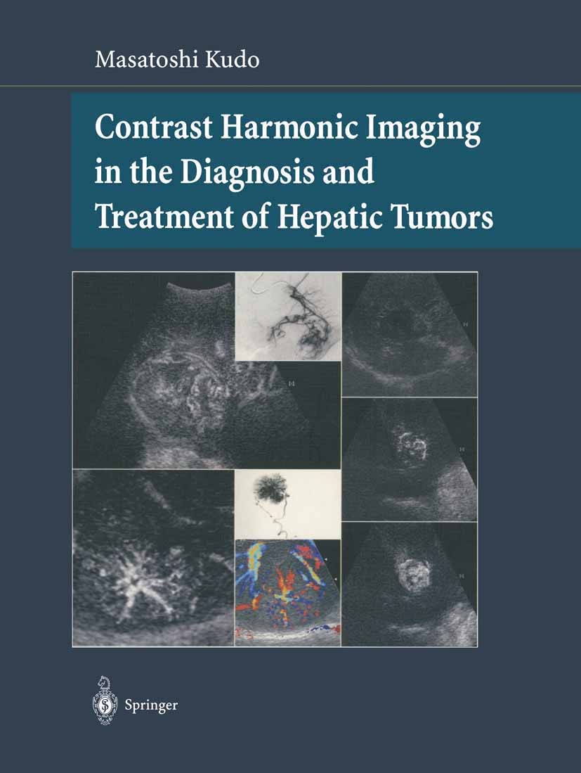 Titlebook: Contrast Harmonic Imaging in the Diagnosis and Treatment of Hepatic Tumors; Masatoshi Kudo Book 20031st edition Springer Japan 2003 carcin Titlebook: Contrast Harmonic Imaging in the Diagnosis and Treatment of Hepatic Tumors; Masatoshi Kudo Book 20031st edition Springer Japan 2003 carcin