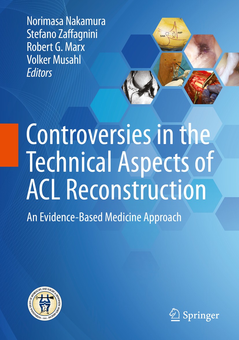 Titlebook: Controversies in the Technical Aspects of ACL Reconstruction; An Evidence-Based Me Norimasa Nakamura,Stefano Zaffagnini,Volker Musahl Book Titlebook: Controversies in the Technical Aspects of ACL Reconstruction; An Evidence-Based Me Norimasa Nakamura,Stefano Zaffagnini,Volker Musahl Book