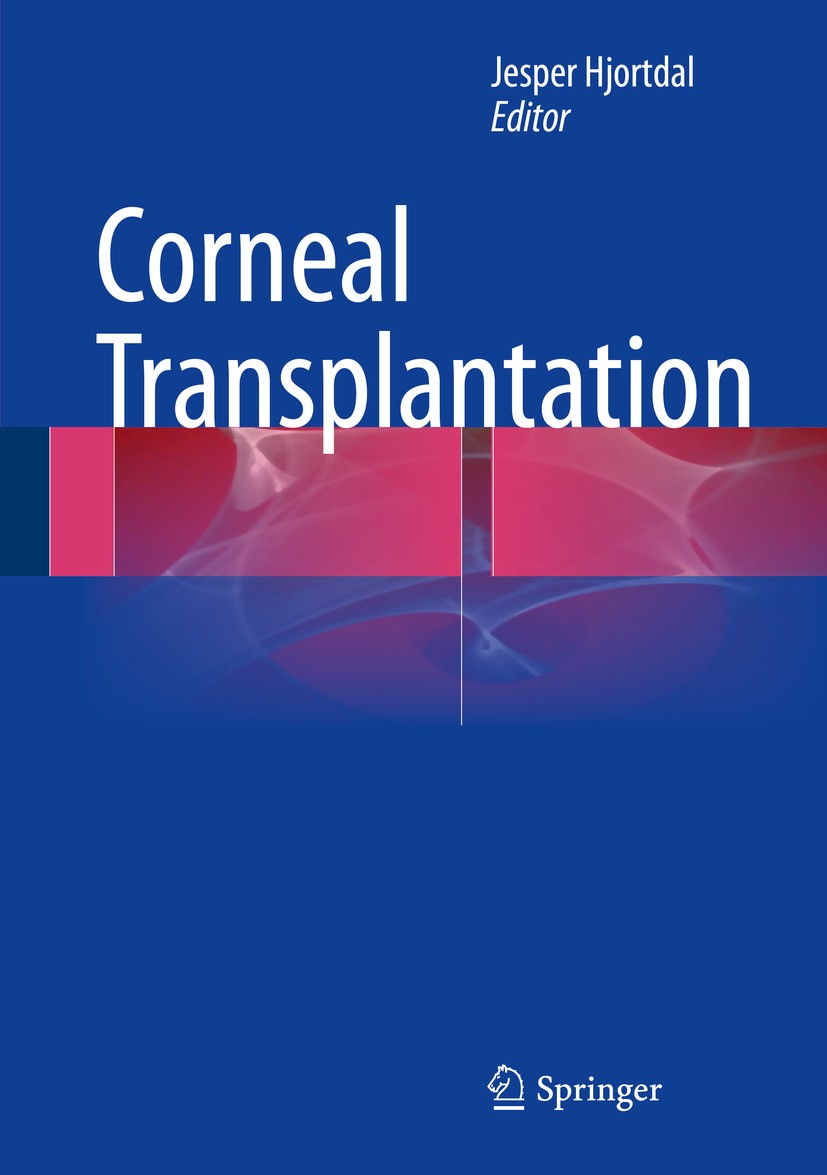 Titlebook: Corneal Transplantation; Jesper Hjortdal Book 2016 Springer International Publishing Switzerland 2016 Anterior lamellar surgery.Corneal ba Titlebook: Corneal Transplantation; Jesper Hjortdal Book 2016 Springer International Publishing Switzerland 2016 Anterior lamellar surgery.Corneal ba