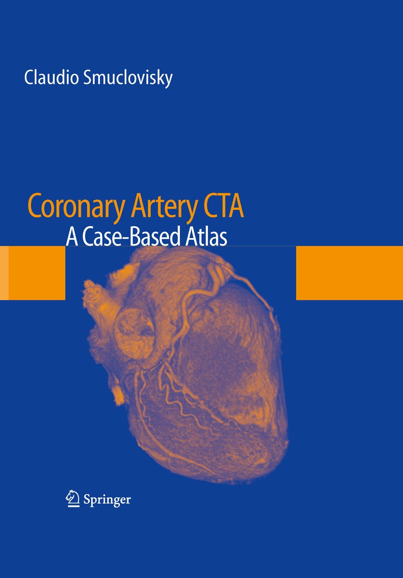 Titlebook: Coronary Artery CTA; A Case-Based Atlas Claudio Smuclovisky Book 20101st edition Springer-Verlag New York 2010 Artery.Bypass.CCTA.CTA.Case- Titlebook: Coronary Artery CTA; A Case-Based Atlas Claudio Smuclovisky Book 20101st edition Springer-Verlag New York 2010 Artery.Bypass.CCTA.CTA.Case-
