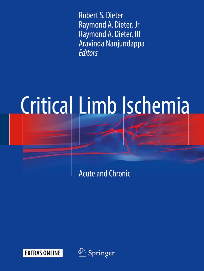 Titlebook: Critical Limb Ischemia; Acute and Chronic Robert S. Dieter,Raymond A. Dieter, Jr,Aravinda Na Book 2017 Springer International Publishing Sw Titlebook: Critical Limb Ischemia; Acute and Chronic Robert S. Dieter,Raymond A. Dieter, Jr,Aravinda Na Book 2017 Springer International Publishing Sw