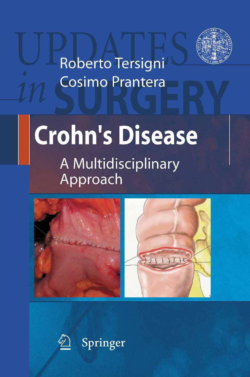 Titlebook: Crohn‘s Disease; A Multidisciplinary Roberto Tersigni (Chief and Chairman),Cosimo Prant Book 2010 Springer-Verlag Milan 2010 Crohn.cancer. Titlebook: Crohn‘s Disease; A Multidisciplinary Roberto Tersigni (Chief and Chairman),Cosimo Prant Book 2010 Springer-Verlag Milan 2010 Crohn.cancer.