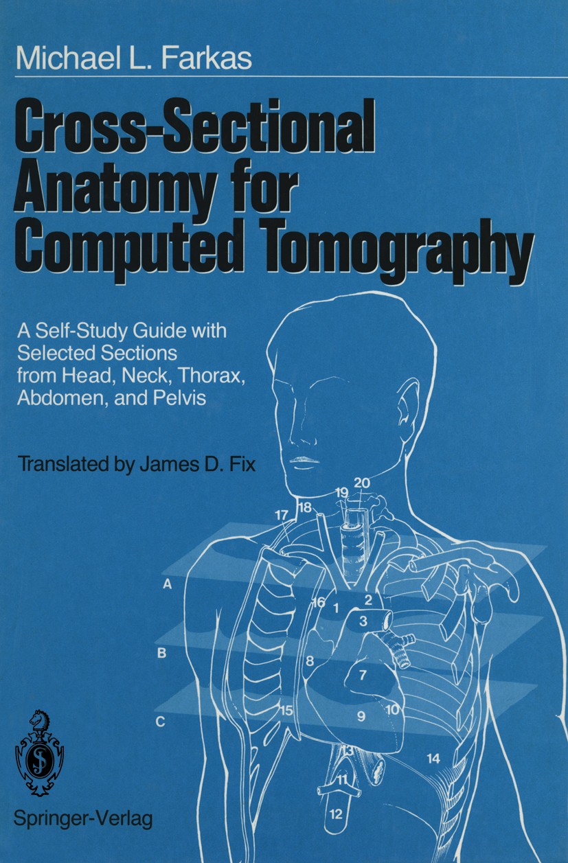 Titlebook: Cross-Sectional Anatomy for Computed Tomography; A Self-Study Guide w Michael L. Farkas (Diplomate) Textbook 1988 Springer-Verlag New York Titlebook: Cross-Sectional Anatomy for Computed Tomography; A Self-Study Guide w Michael L. Farkas (Diplomate) Textbook 1988 Springer-Verlag New York