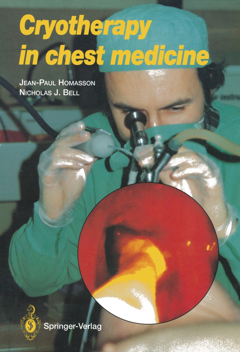 Titlebook: Cryotherapy in Chest Medicine; Jean-Paul Homasson,Nicholas Bell Book 1992 Springer-Verlag France, Paris 1992 Laser.anesthesia.biopsy.breat Titlebook: Cryotherapy in Chest Medicine; Jean-Paul Homasson,Nicholas Bell Book 1992 Springer-Verlag France, Paris 1992 Laser.anesthesia.biopsy.breat