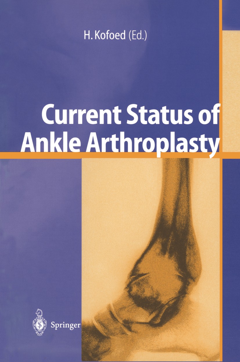 Titlebook: Current Status of Ankle Arthroplasty; Hakon Kofoed Conference proceedings 1998 Springer-Verlag Berlin · Heidelberg 1998 Gelenkersatz.Sprun Titlebook: Current Status of Ankle Arthroplasty; Hakon Kofoed Conference proceedings 1998 Springer-Verlag Berlin · Heidelberg 1998 Gelenkersatz.Sprun