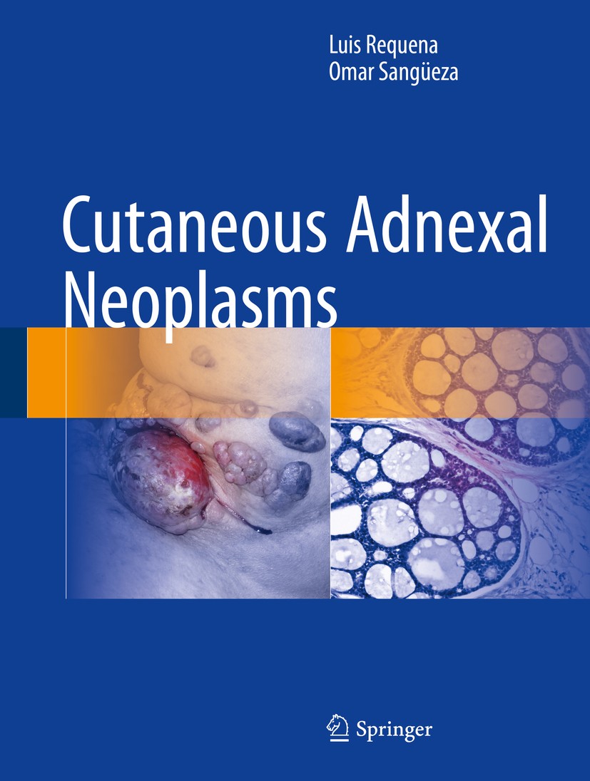 Titlebook: Cutaneous Adnexal Neoplasms; Luis Requena,Omar Sangüeza Book 2017 Springer International Publishing Switzerland 2017 Eccrine differentiati Titlebook: Cutaneous Adnexal Neoplasms; Luis Requena,Omar Sangüeza Book 2017 Springer International Publishing Switzerland 2017 Eccrine differentiati